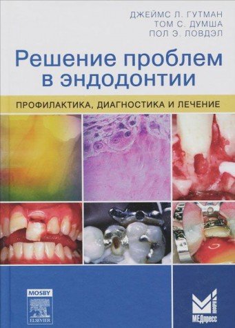 Решение проблем в эндодонтии. Профилактика,диагностика и лечение 2-е изд.