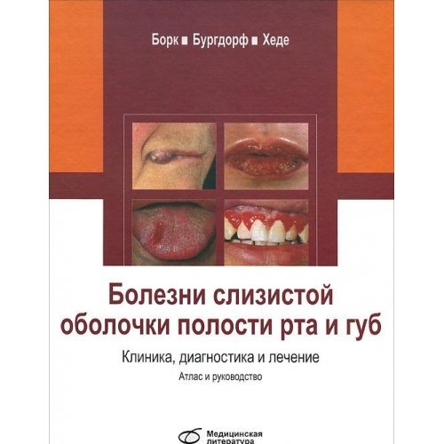 Болезни слизистой оболочки полости рта и губ. Клиника,диагностика и лечение. Атлас и руководство