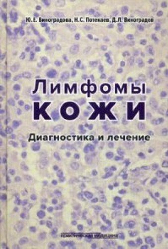 Лимфомы кожи:диагностика и лечение