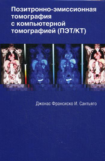 Позитрон.-эмисионная томограф.с компьют.томографии