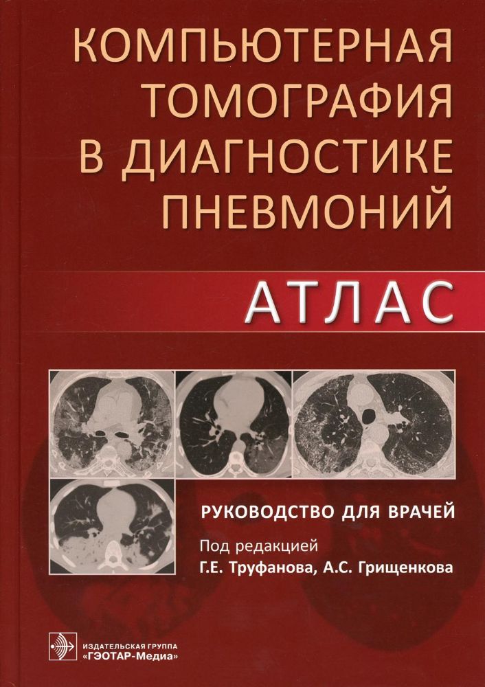 Компьютерная томография в диагностике пневмоний