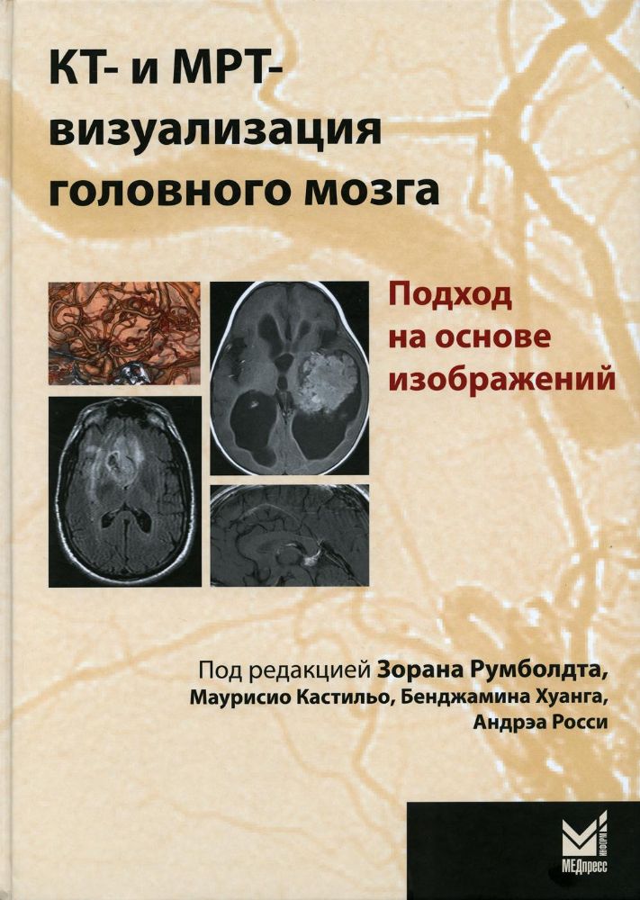 КТ- и МРТ- визуализация головного мозга. Подход на основе изображений. 2-е изд