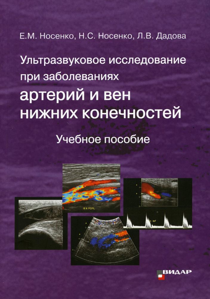 Ультразвуковое исследование при заболеваниях артерий и вен нижних конечностей: Учебное пособие