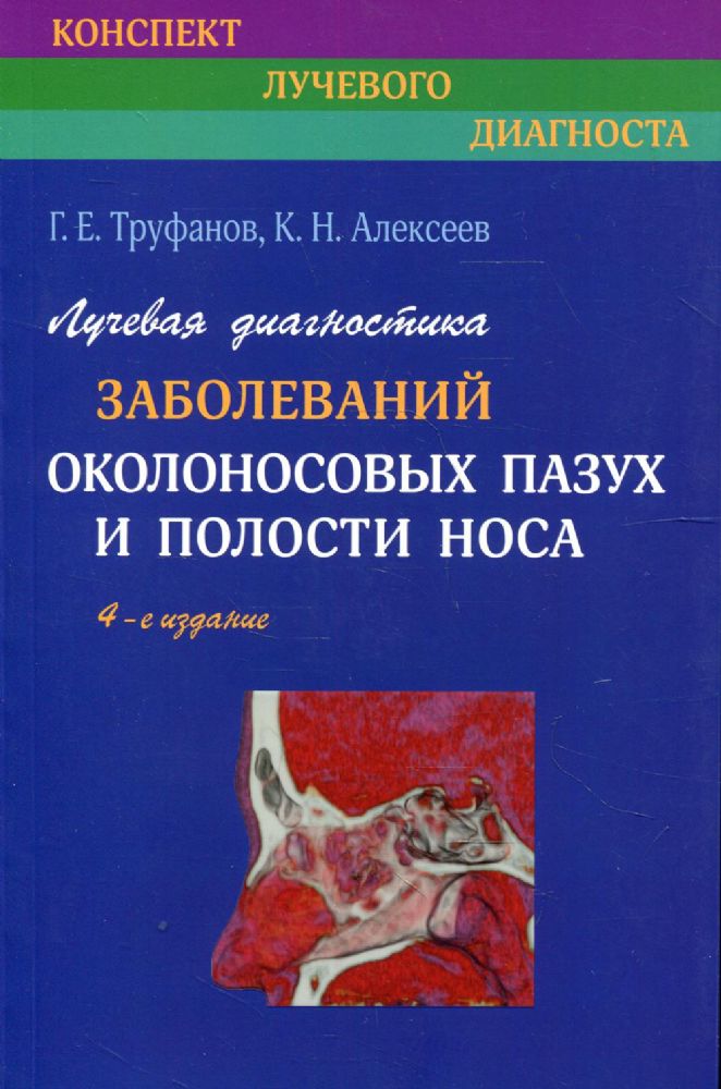 Лучевая диагностика заболеваний околоносовых пазух и полости носа. 4-е изд., испр. и доп