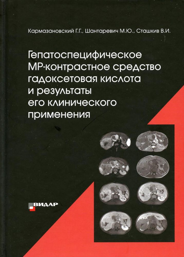 Гепатоспецифическое МР-контрастное средство гадоксетовая кислота и результаты его клинического применения