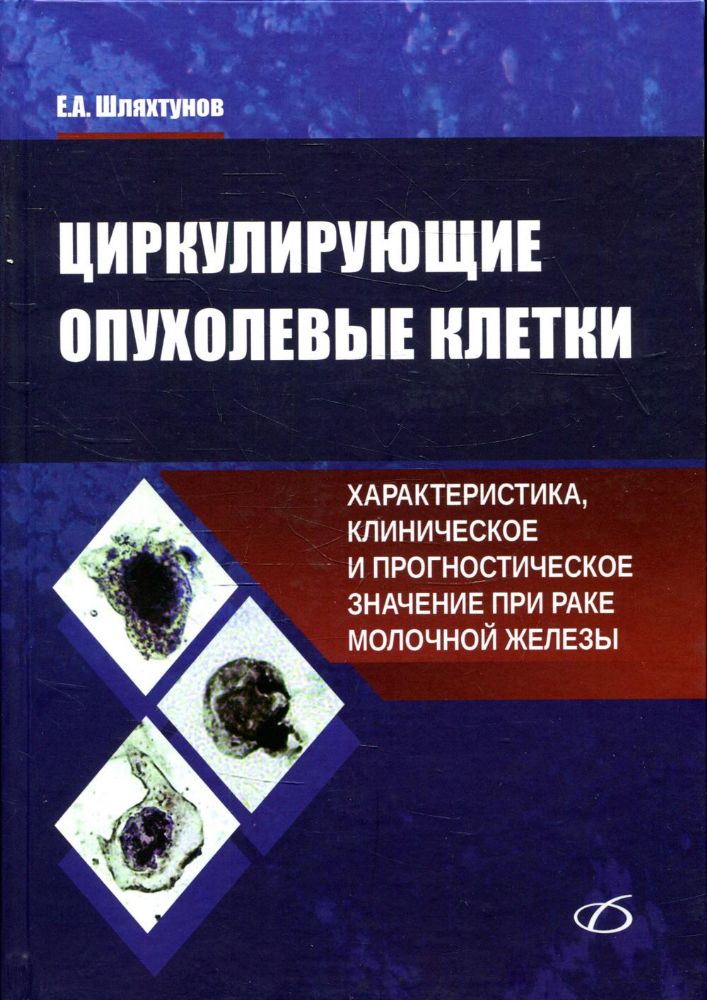 Циркулирующие опухолевые клетки: характеристика, клиническое и прогностическое значение при раке молочной железы