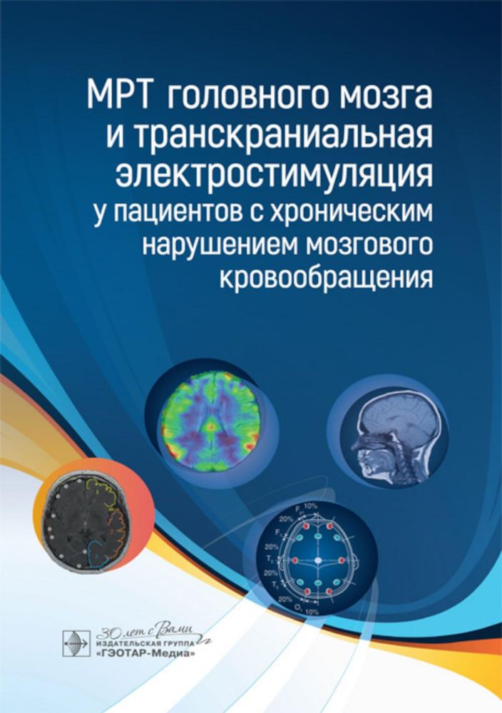 МРТ головного мозга и транскраниальная электростимуляц.у пациентов с хронич.нару