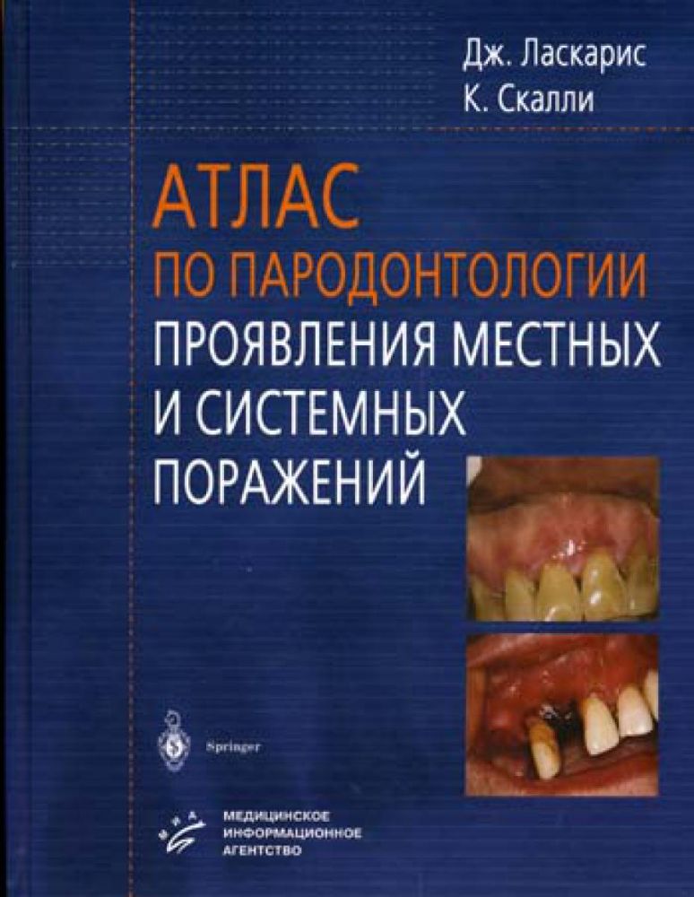 Атлас по пародонтологии. Проявления местных и системных поражений