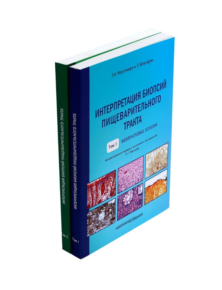 Интерпретация биопсий пищеварительного тракта: В 2-х т. (комплект в 2-х книг)