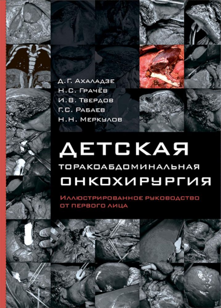 Детская торакоабдоминальная онкохирургия. Иллюстрированное руководство от первого лица